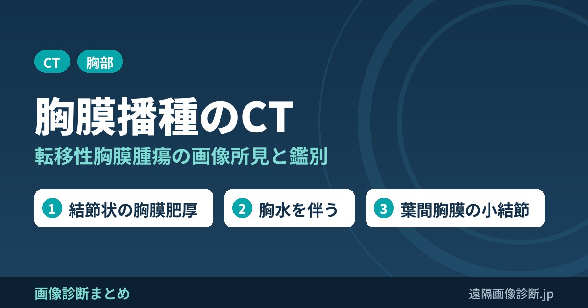 胸膜播種、転移性胸膜腫瘍のCT画像診断