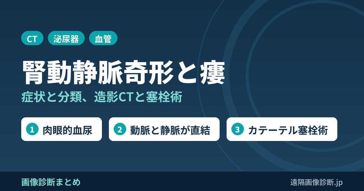 腎動静脈奇形・腎動静脈瘻とは？症状(肉眼的血尿)・分類と造影CT画像、塞栓術
