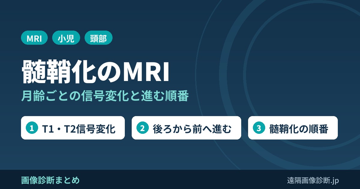髄鞘化のMRI画像診断｜月齢ごとのT1・T2信号変化と進む順番、terminal zone