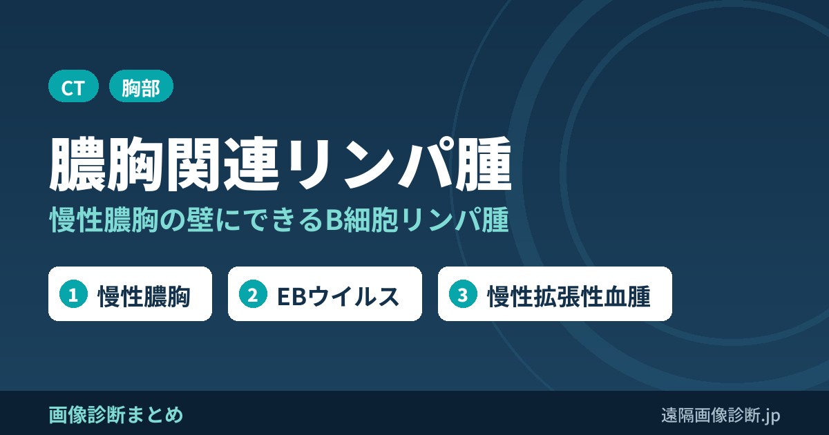 膿胸関連悪性リンパ腫の画像診断