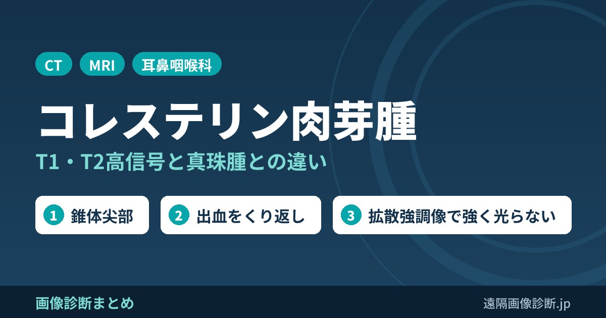 コレステリン肉芽腫のCT・MRI画像所見｜T1・T2高信号と真珠腫との違い