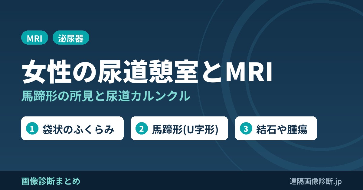 尿道憩室とは？女性に多い原因・症状とMRI画像所見(馬蹄形)、尿道カルンクルとの違い