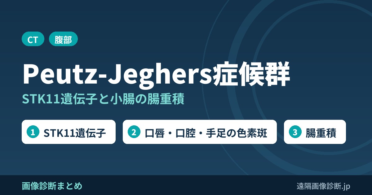 Peutz-Jeghers症候群の症状、合併症、治療