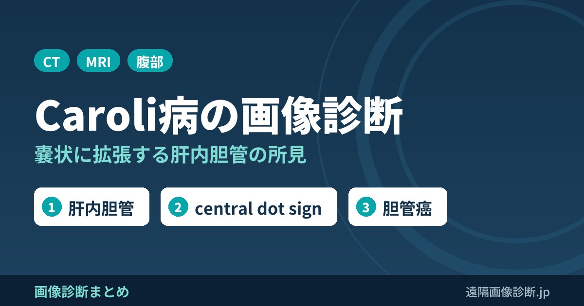 Caroli病(カロリ病)とは？画像診断のポイントは？