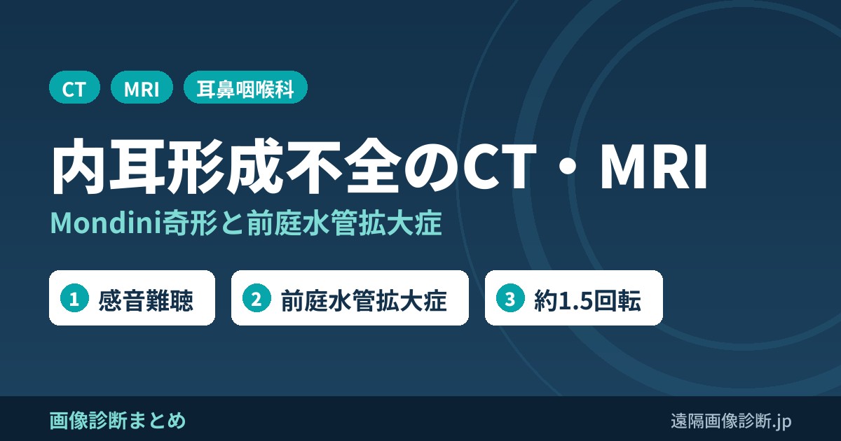 内耳の形成不全のCT・MRI画像診断｜Mondini奇形・前庭水管拡大症