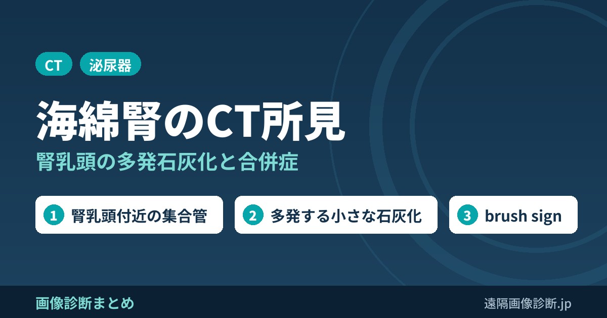 海綿腎とは？CT画像の特徴は？症状、合併症は？