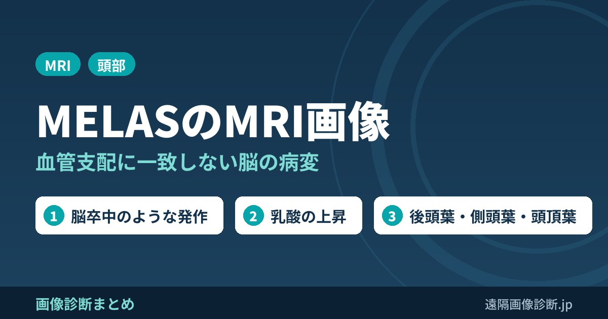 MELAS(ミトコンドリア脳筋症)のMRI画像診断｜脳卒中様発作と血管支配に一致しない病変