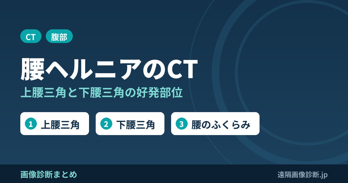 腰ヘルニア(lumbar hernia)とは？好発部位(上腰三角・下腰三角)とCT所見