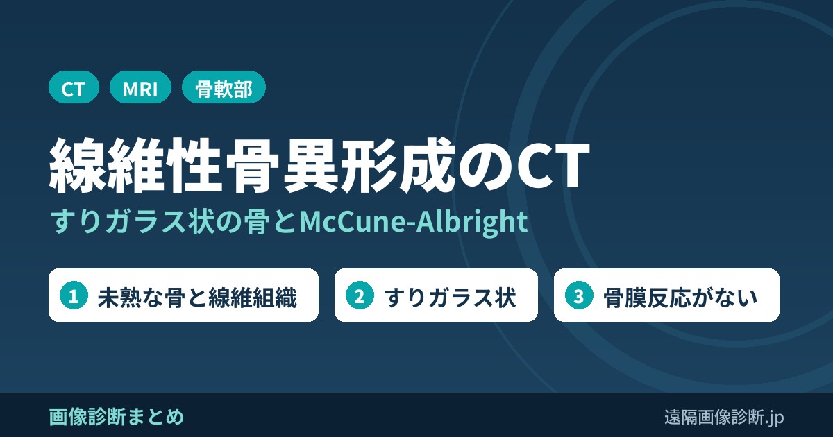 線維性骨異形成(FD)のCT・MRI画像所見｜すりガラス状の骨とMcCune-Albright症候群