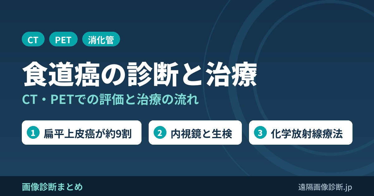 食道癌の症状は？診断、治療まとめ！