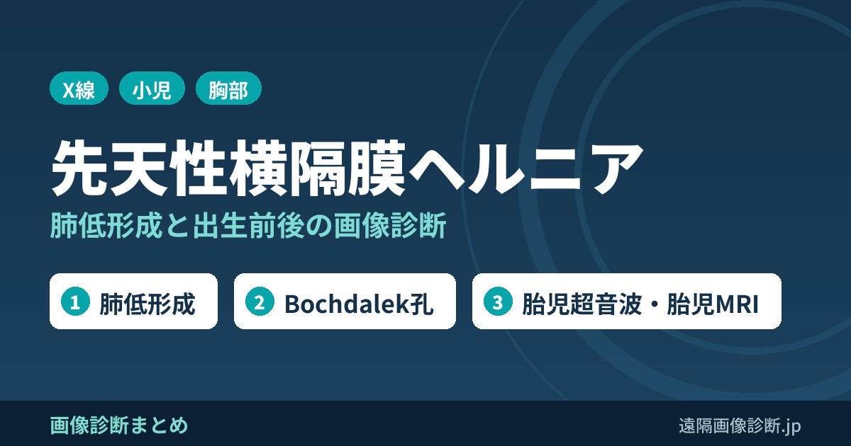 先天性横隔膜ヘルニアの症状、合併症、画像診断