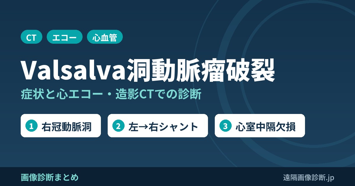 Valsalva洞動脈瘤破裂の症状、原因、画像診断