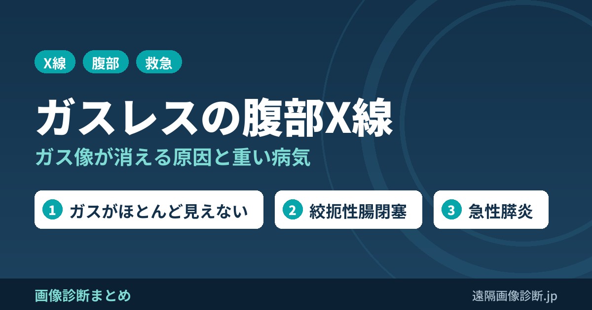 ガスレス(gasless abdomen)とは？腹部レントゲンでガス像が消える原因と見逃してはいけない病気