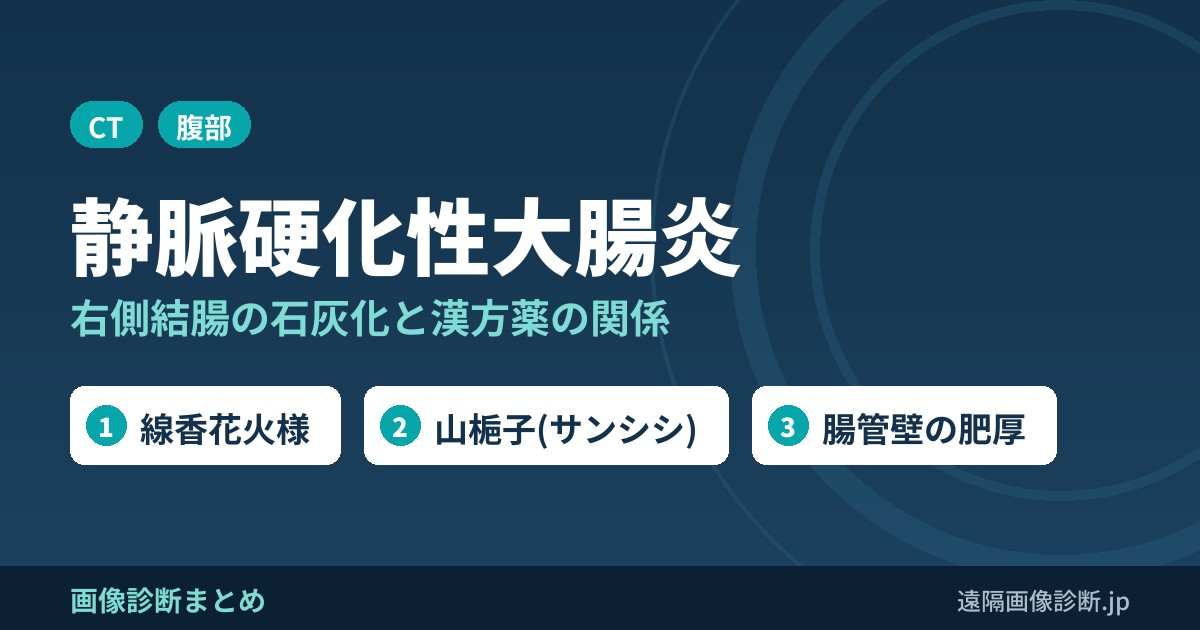 静脈硬化性大腸炎の症状、好発部位、画像診断