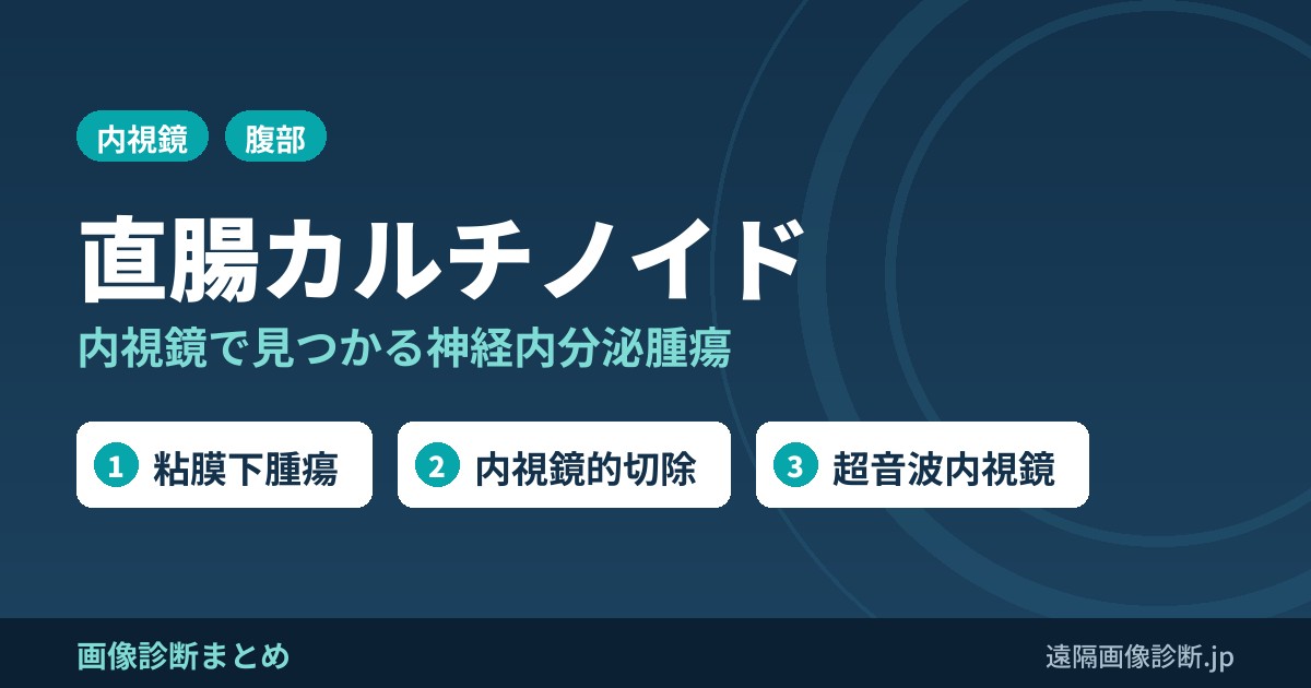 直腸カルチノイド(NET)とは？症状、画像診断、治療は？