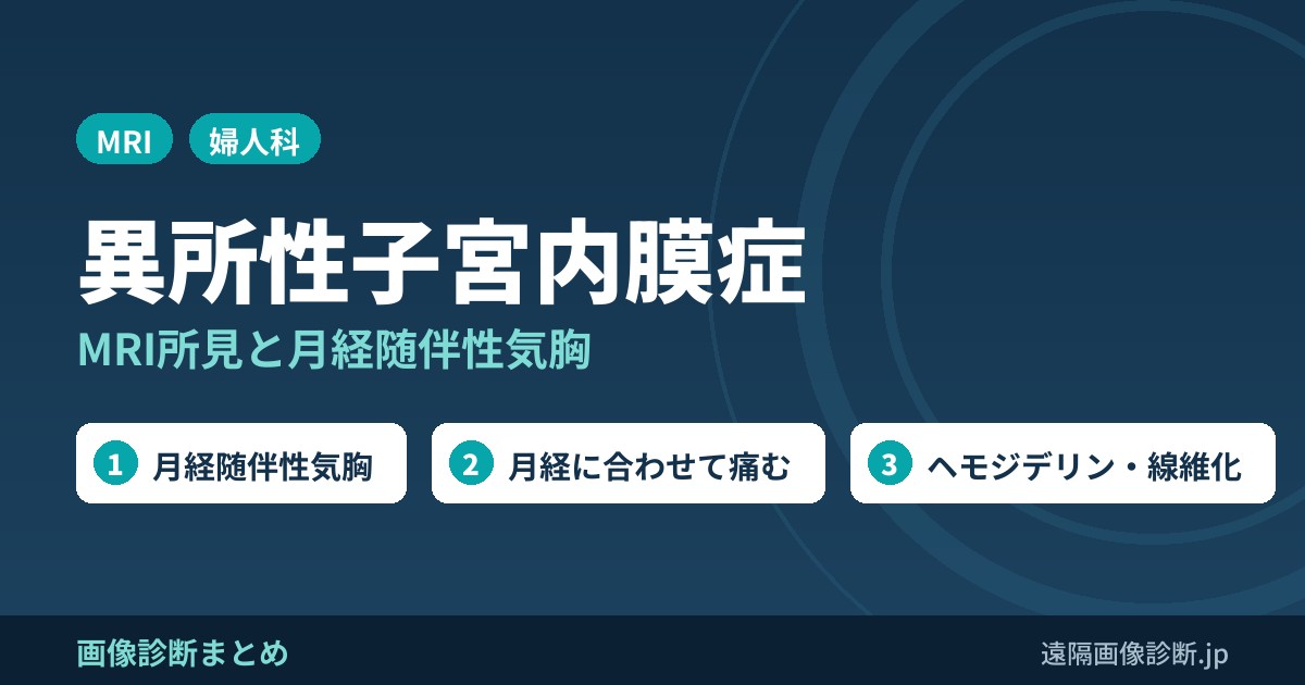 異所性子宮内膜症とは？MRI画像診断のポイントは？