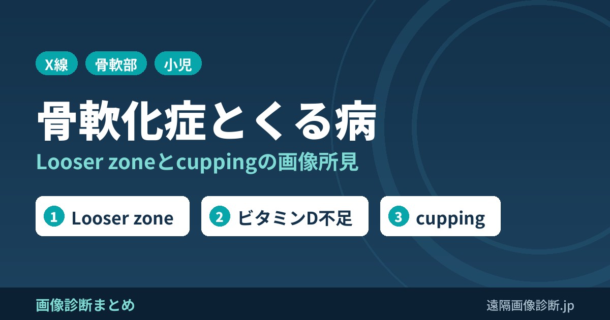 骨軟化症、くる病の画像診断