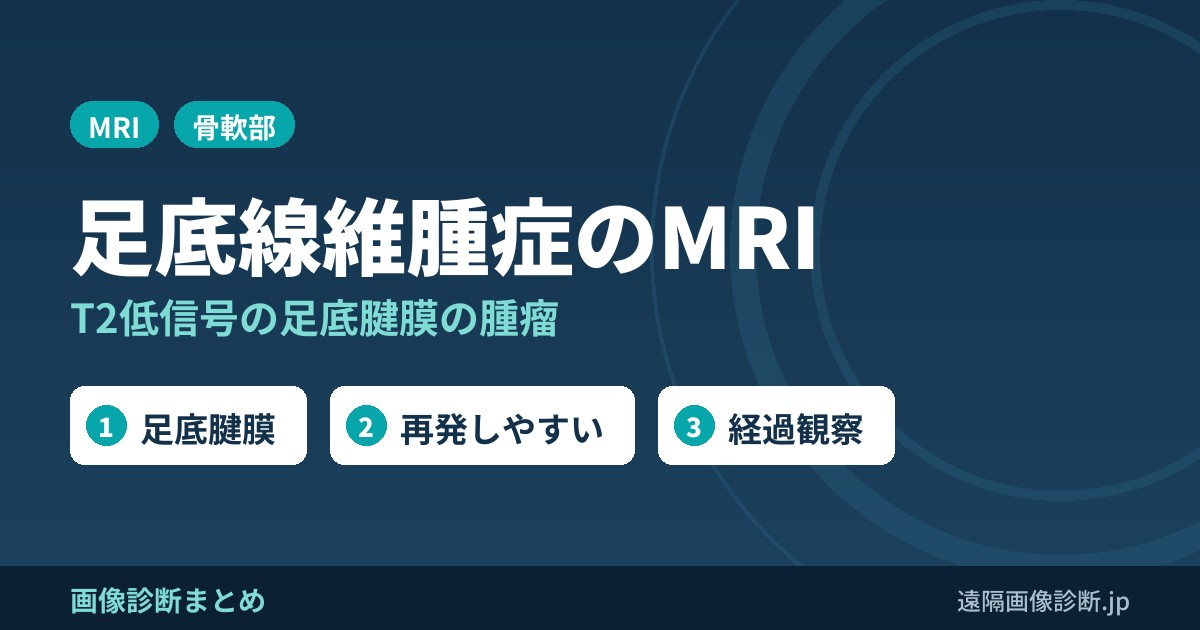 足底線維腫症(plantar fibromatosis)のMRI画像所見｜T2低信号の足底腫瘤