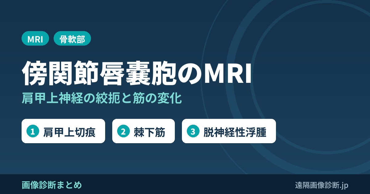 傍関節唇嚢胞による肩甲上神経絞扼症候群のMRI画像診断