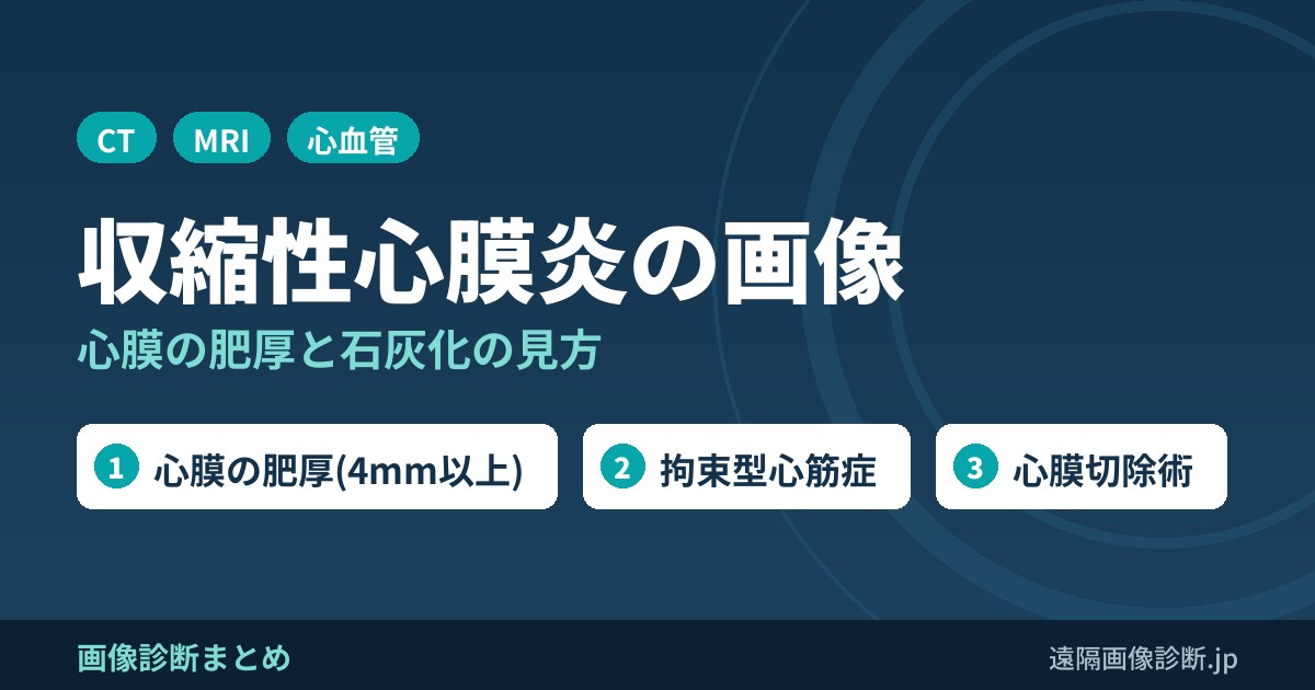 収縮性心膜炎とは？画像診断のポイントは？