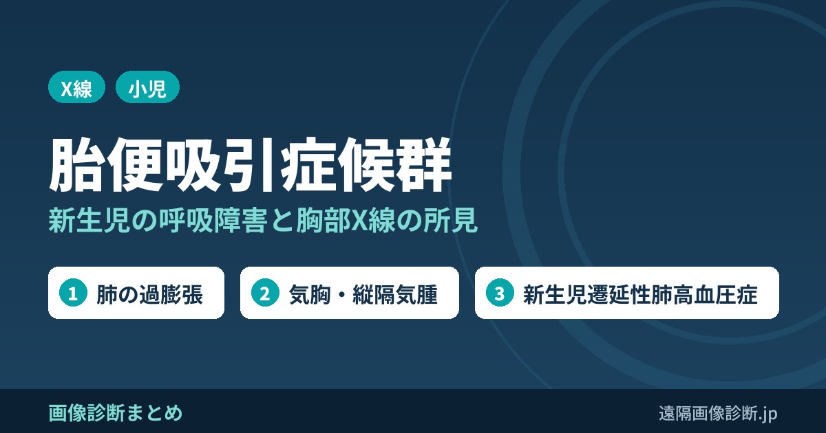 胎便吸引症候群の画像診断