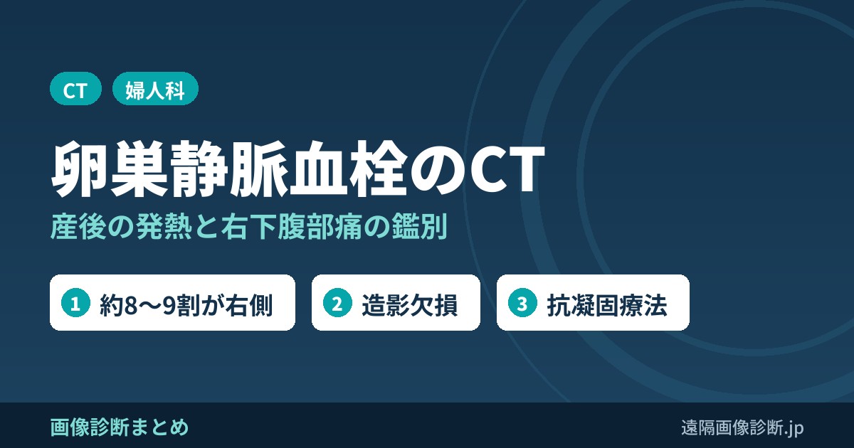 卵巣静脈血栓の症状は？原因は？画像診断のポイントは？
