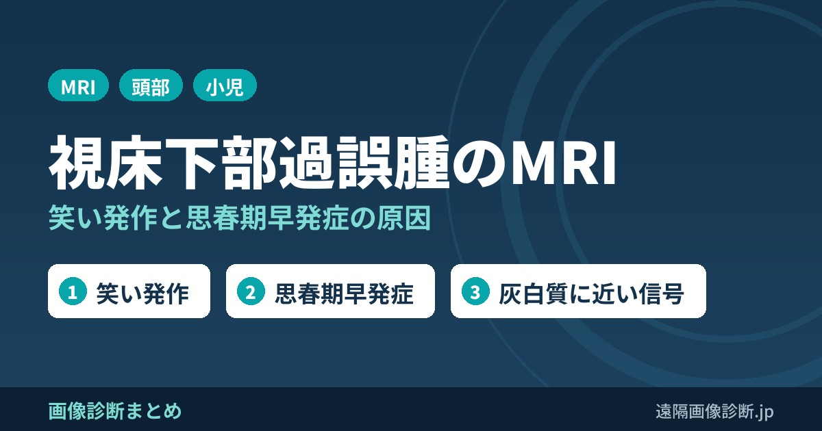 視床下部過誤腫のMRI画像診断