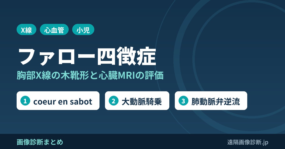 ファロー四徴症の画像診断