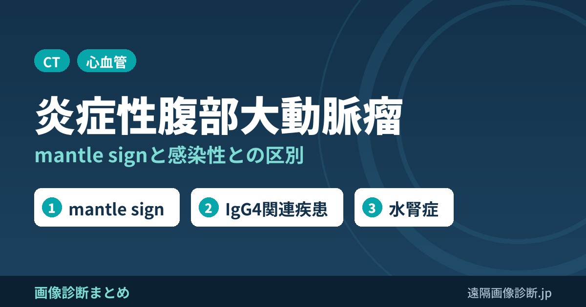 炎症性腹部大動脈瘤の画像診断
