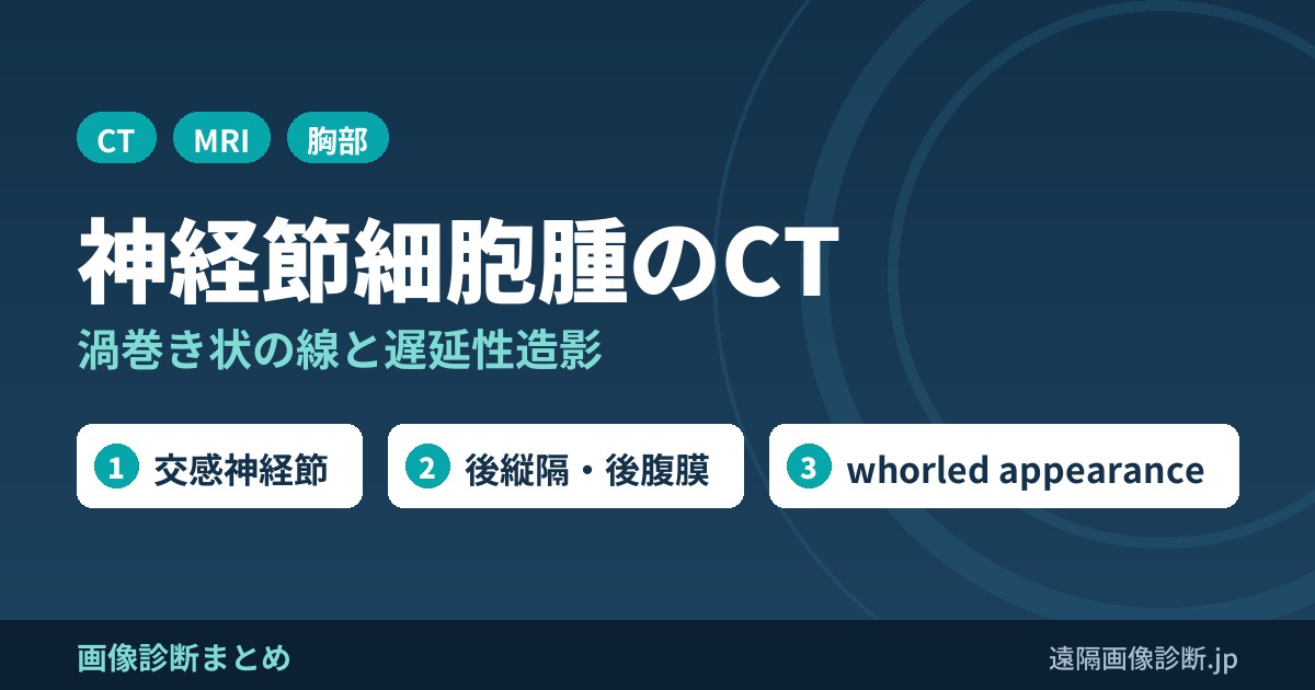 神経節細胞腫(ganglioneuroma)のCT・MRI画像所見｜whorled appearance