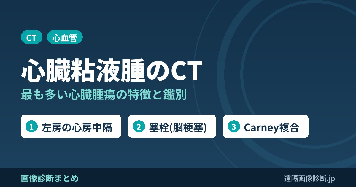 心臓粘液腫とは？CT画像診断のポイントは？
