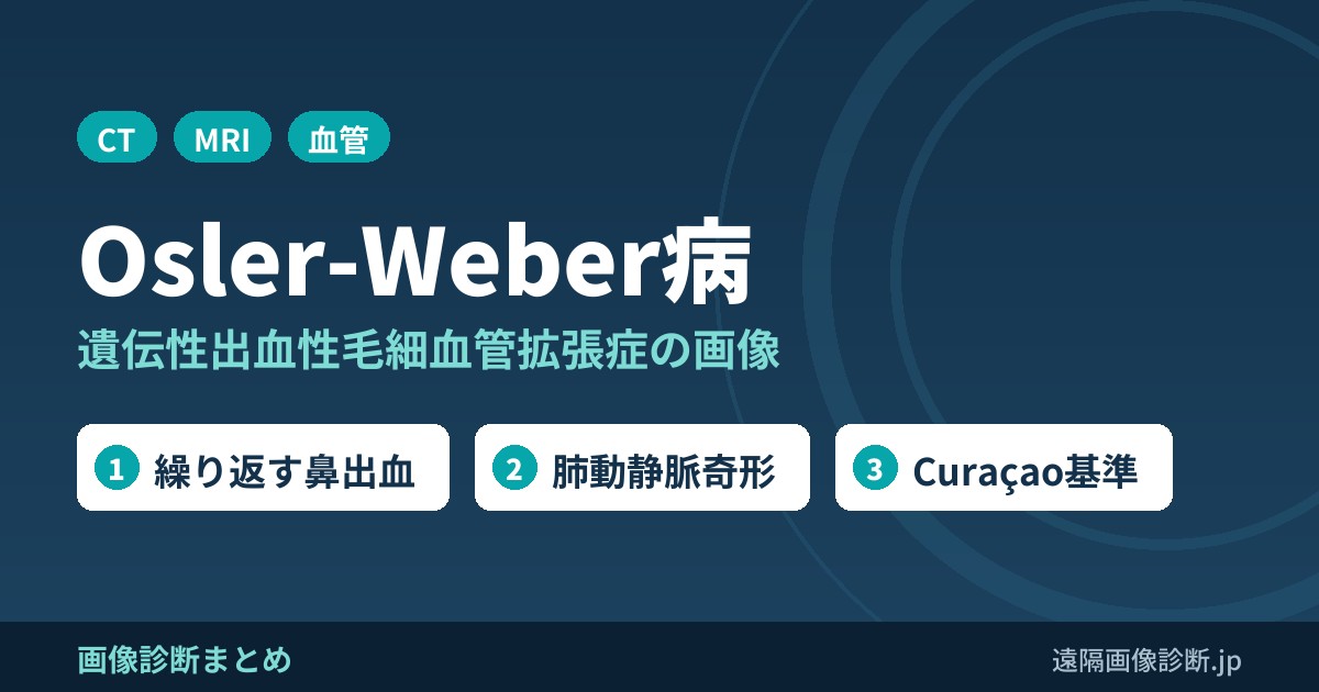 Rendu-Osler-Weber病(遺伝性出血性毛細血管拡張症)とは？画像診断の特徴は？