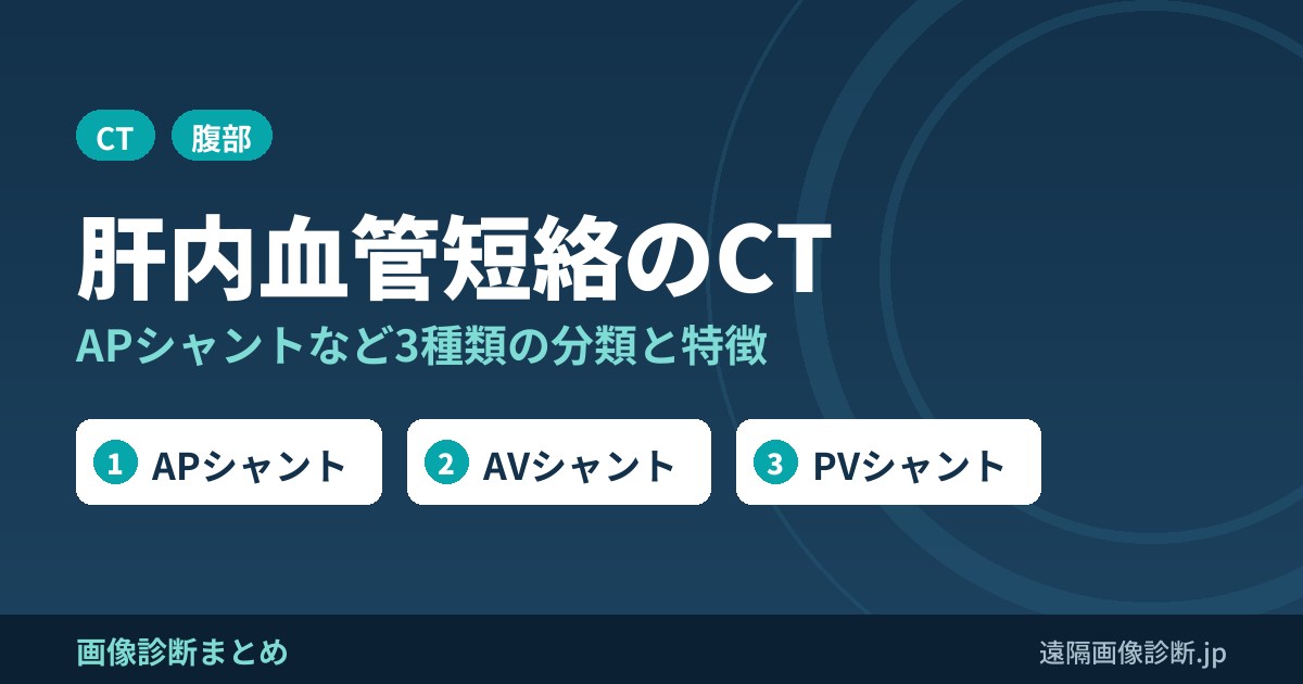 肝内血管短絡(APシャント・AVシャント・PVシャント)の分類と特徴、CT画像