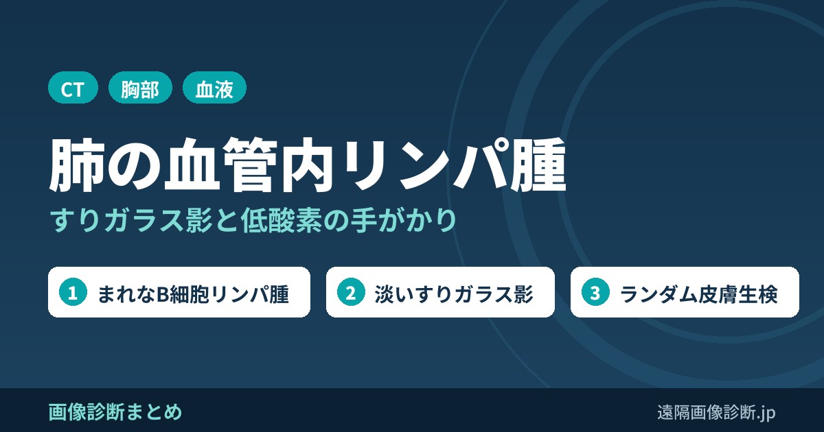 肺血管内リンパ腫の画像診断