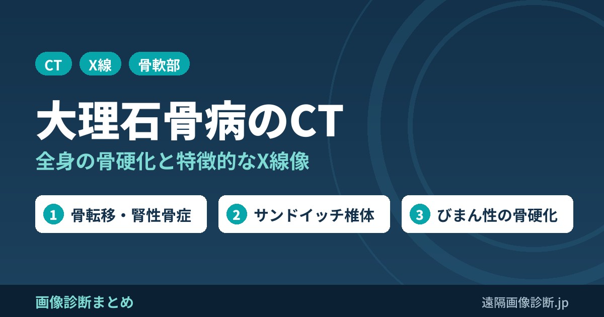 大理石骨病とは？CT画像診断のポイントは？