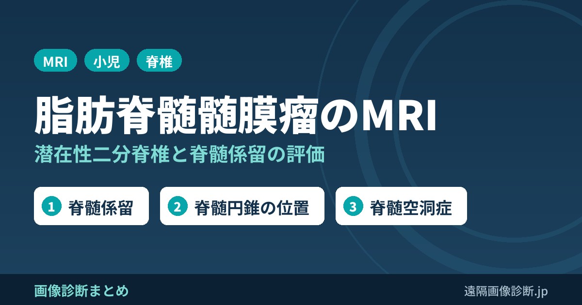 脂肪脊髄(髄膜)瘤の画像診断