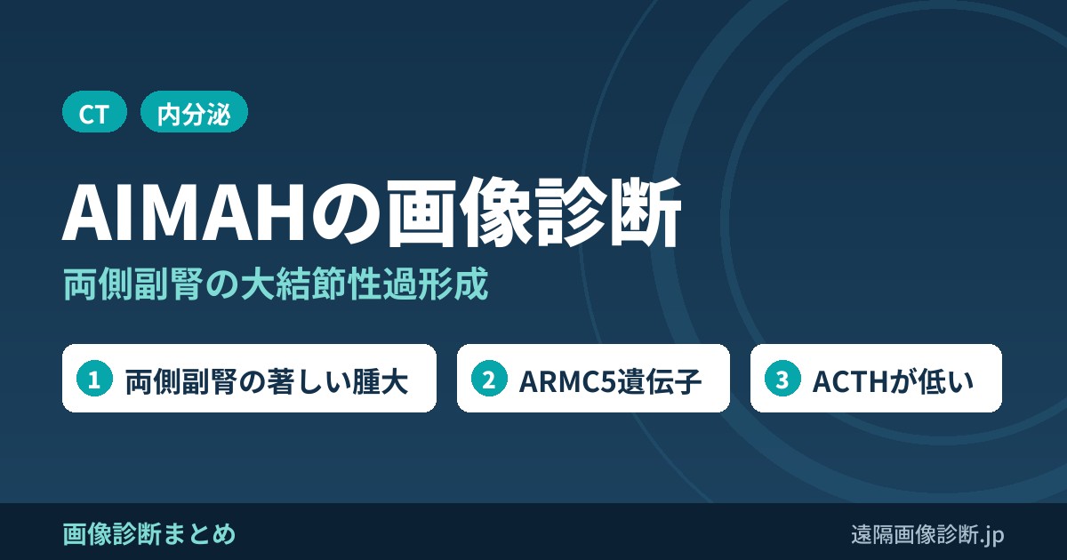 ACTH非依存性大結節性副腎過形成(AIMAH)の画像診断