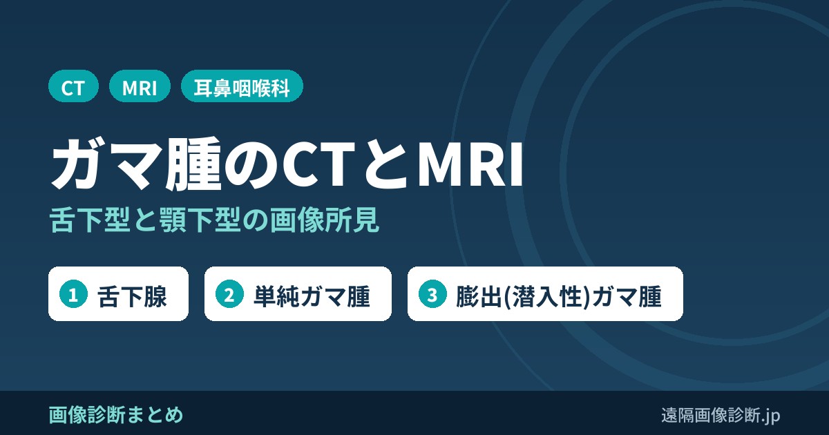 ガマ腫とは？口の底・あごの下のはれ(舌下型・顎下型)とCT・MRI・エコー画像所見