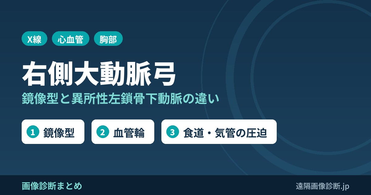右側大動脈弓の画像診断