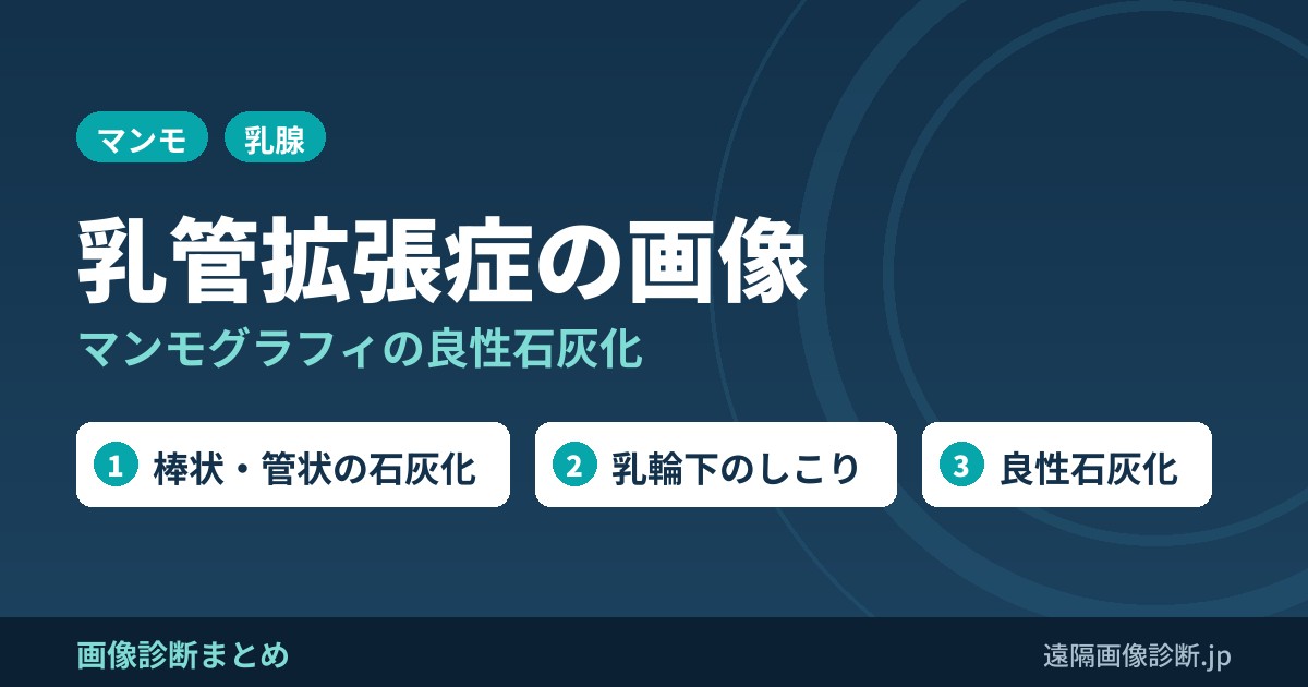 乳管拡張症の画像診断