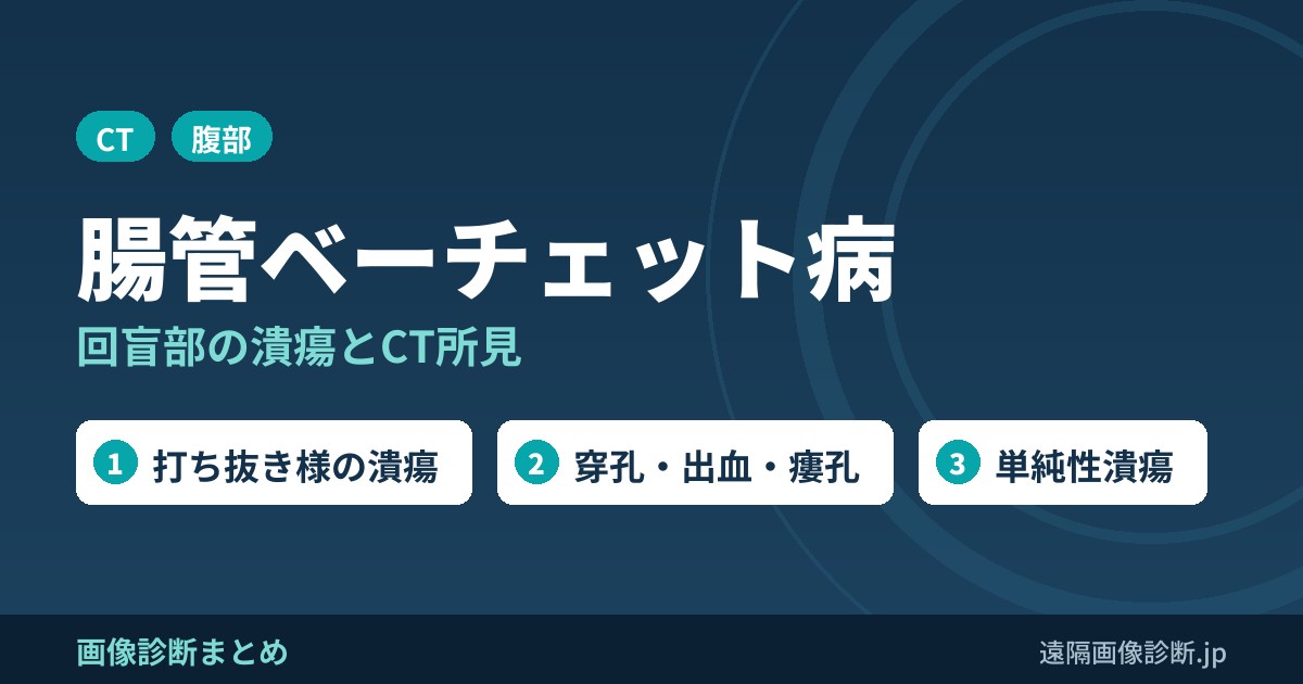 腸管ベーチェット病の画像診断