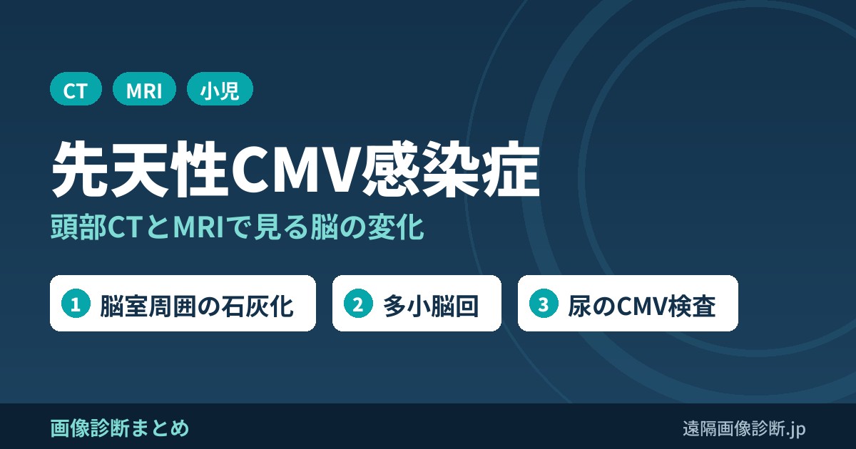 先天性サイトメガロウイルス感染症の画像診断