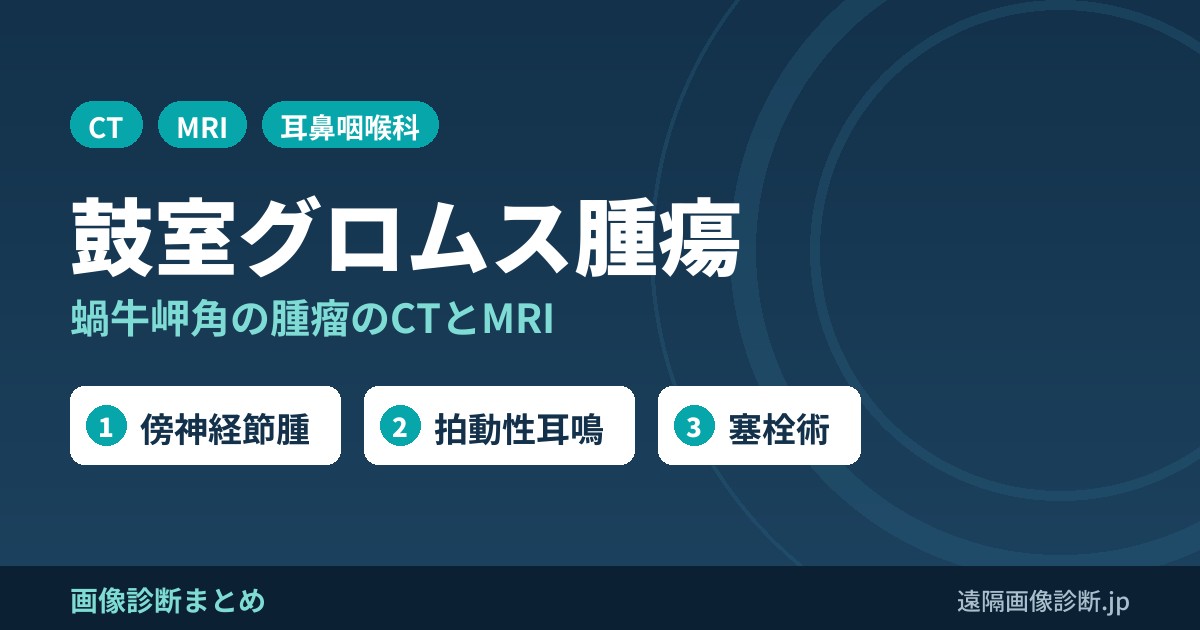 鼓室グロムス腫瘍とは？画像診断のポイントは？