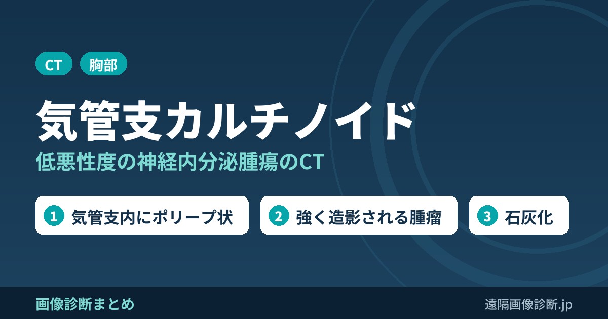 気管支カルチノイドの画像診断
