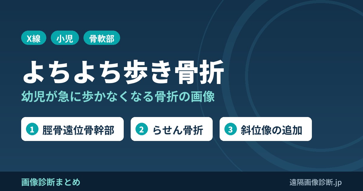 よちよち歩き骨折の画像診断