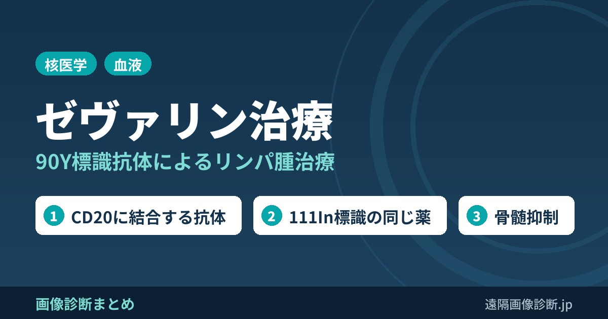 90YによるCD20陽性悪性リンパ腫の治療とは？