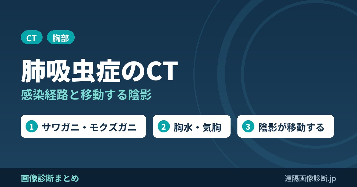 肺吸虫症のCT画像診断