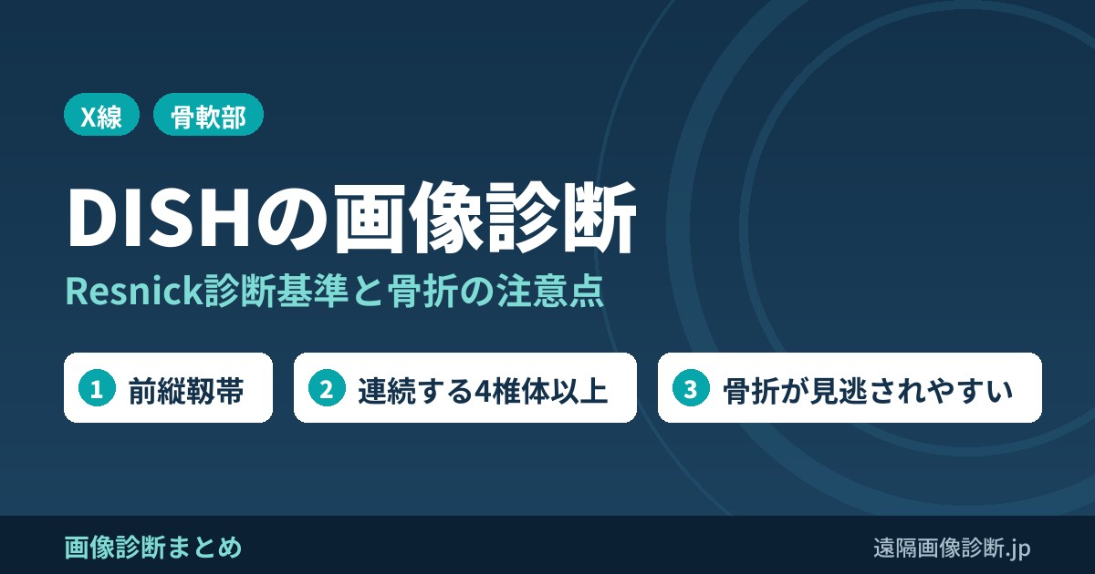 DISH(強直性脊椎骨増殖症・Forestier病)とは？診断基準と画像所見、骨折の注意点