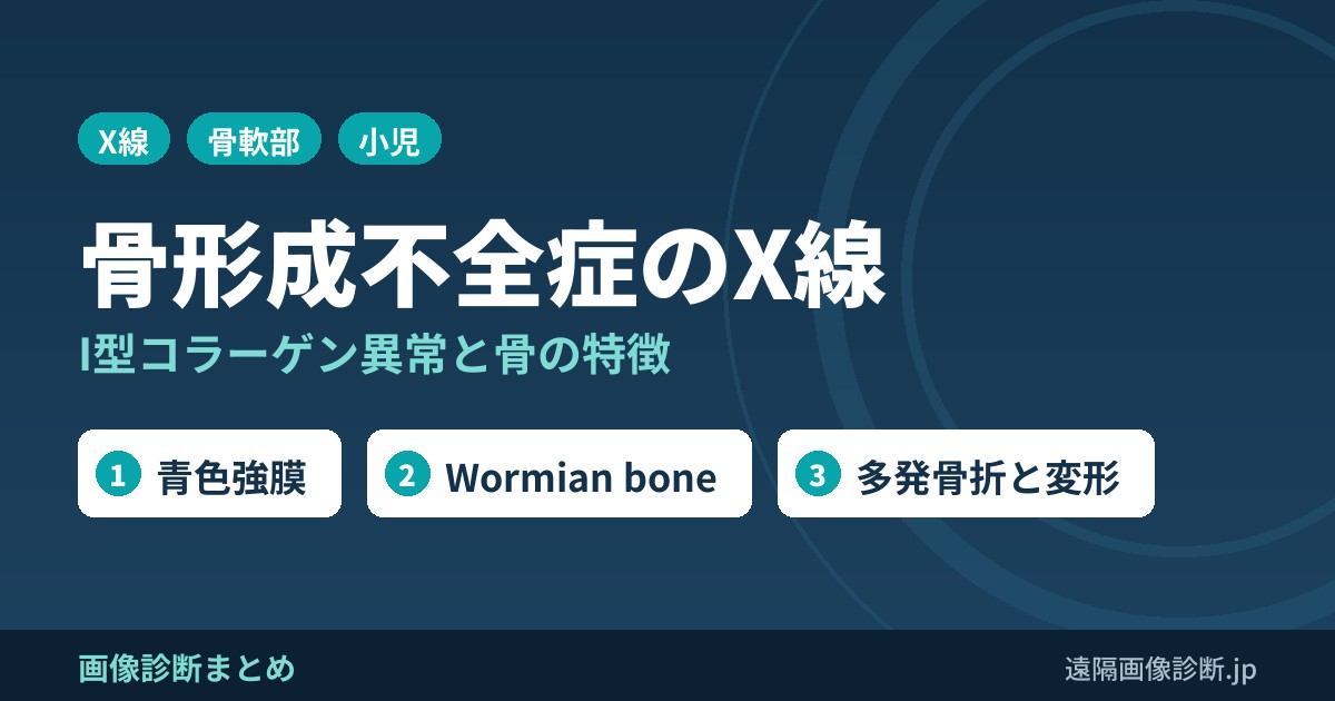 骨形成不全症とは？画像診断の特徴は？