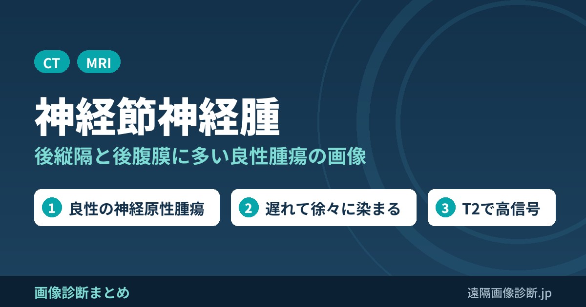 神経節神経腫の画像診断